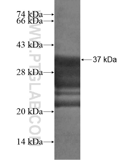 MICAL3 fusion protein Ag19351 SDS-PAGE MICAL3 fusion protein Ag19351 SDS-PAGE