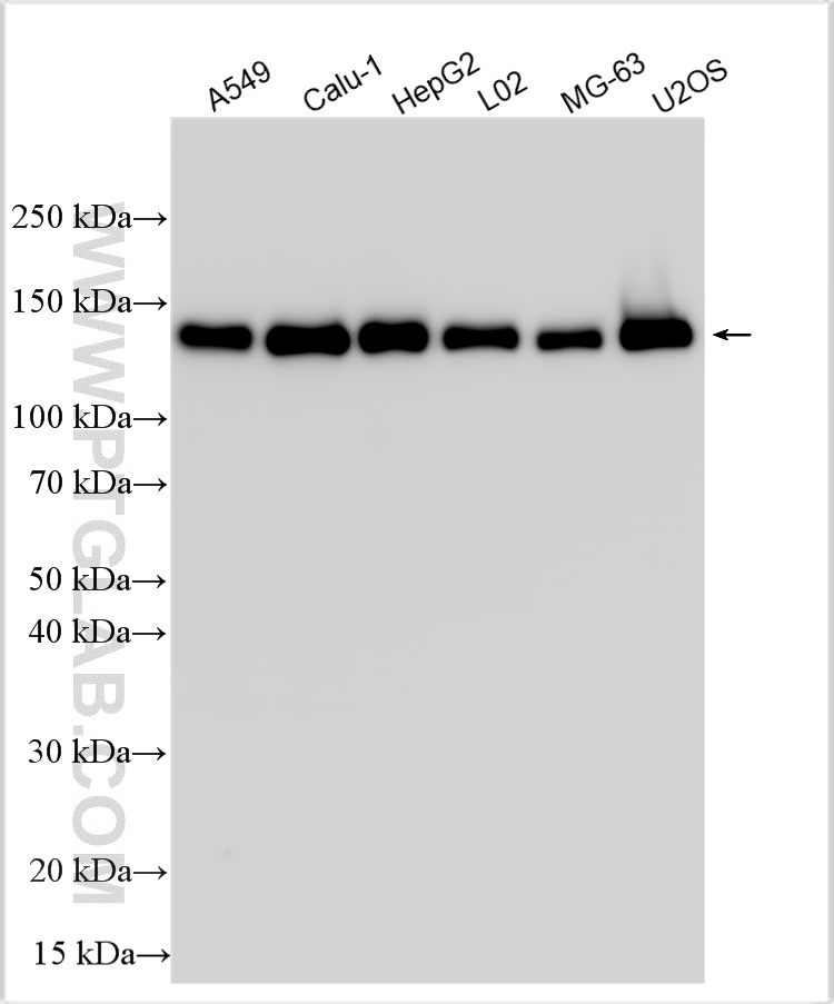 WB analysis using 33503-1-AP (same clone as 33503-1-PBS) WB analysis using 33503-1-AP (same clone as 33503-1-PBS)