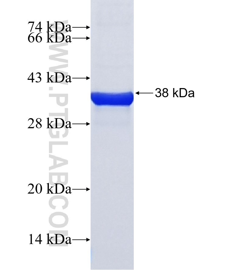 MICALL1 fusion protein Ag39169 SDS-PAGE MICALL1 fusion protein Ag39169 SDS-PAGE