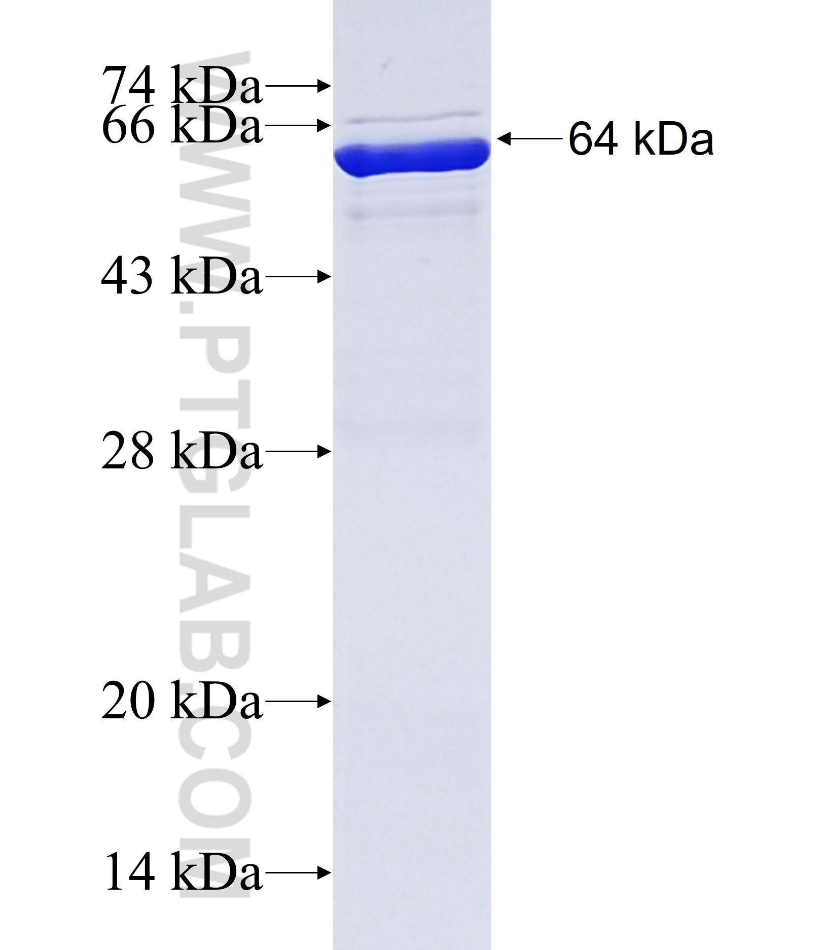 MID1 fusion protein Ag38146 SDS-PAGE MID1 fusion protein Ag38146 SDS-PAGE