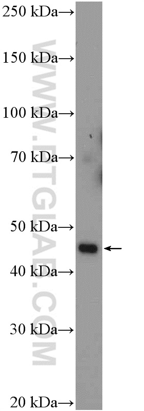 WB analysis of BxPC-3 using 18939-1-AP