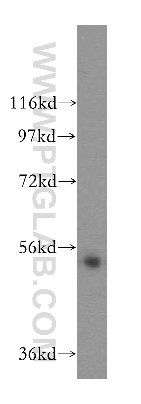 WB analysis of mouse uterus using 17543-1-AP