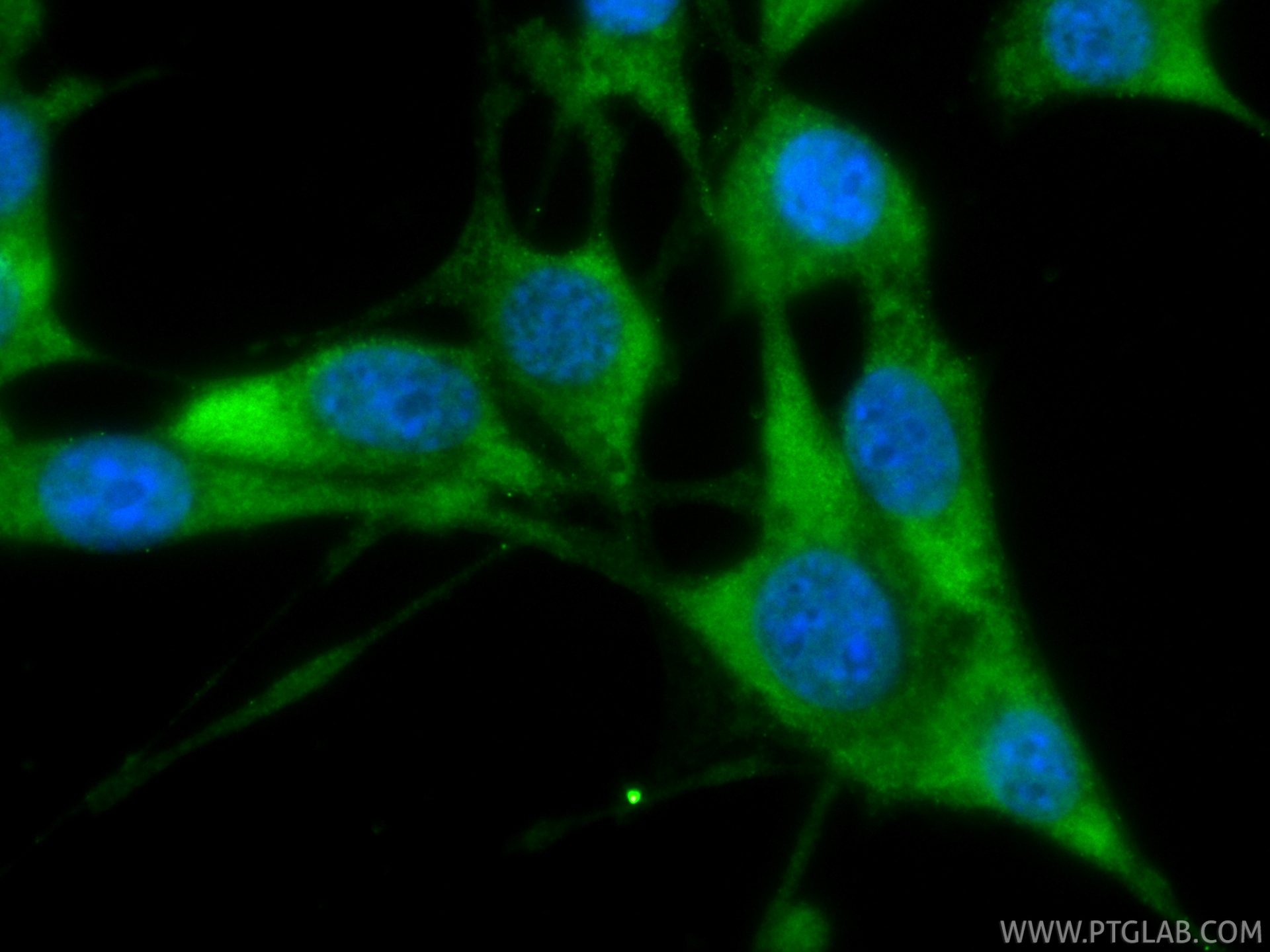 IF Staining of NIH/3T3 using CL488-83199-2 IF Staining of NIH/3T3 using CL488-83199-2