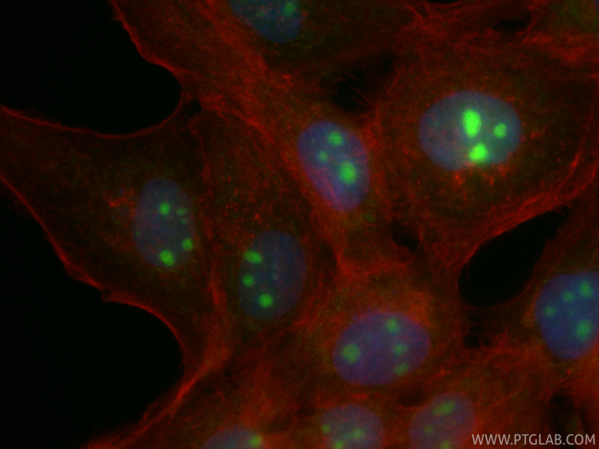 IF Staining of A431 using CL488-86760-3 IF Staining of A431 using CL488-86760-3