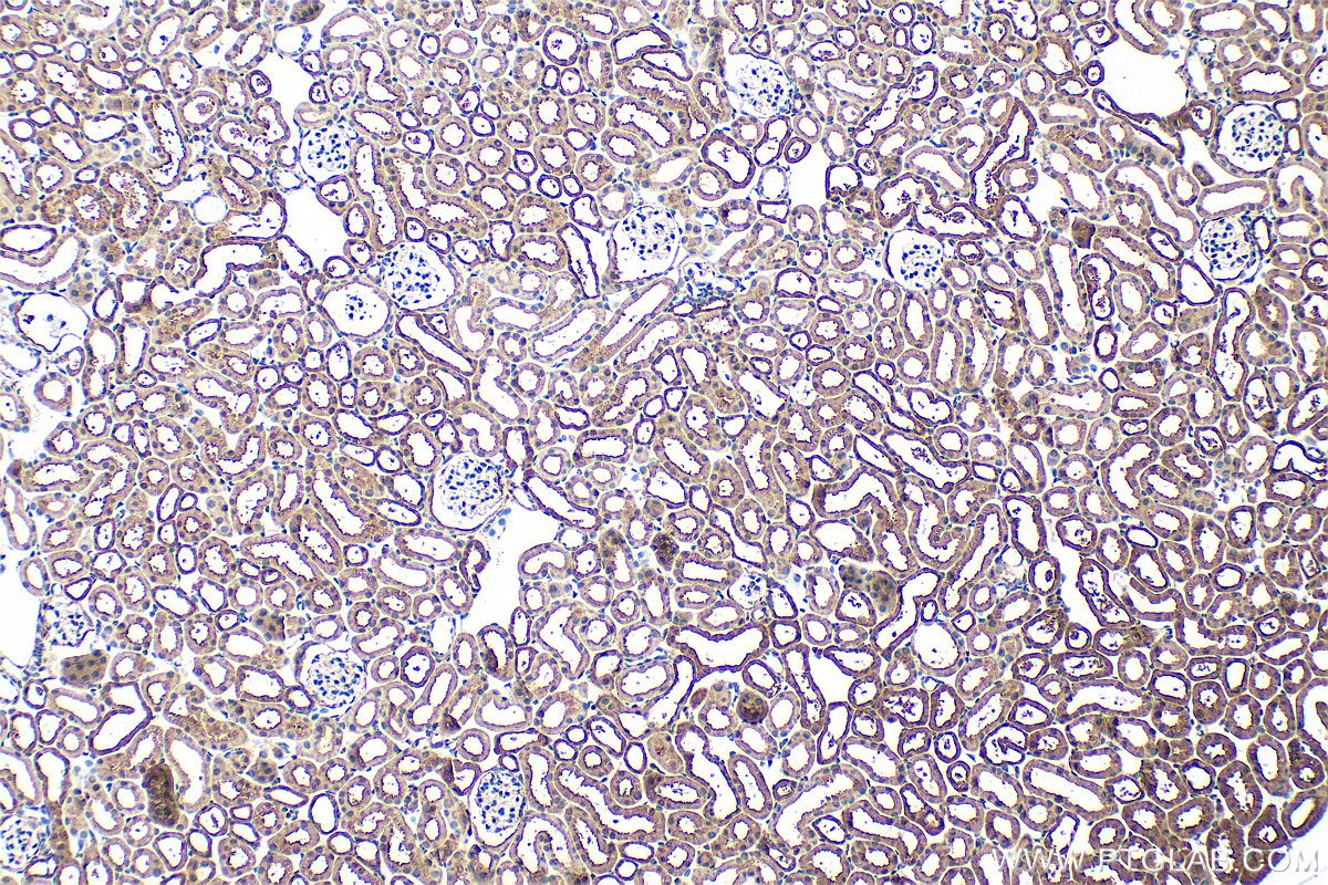 IHC staining of mouse kidney using 26478-1-AP