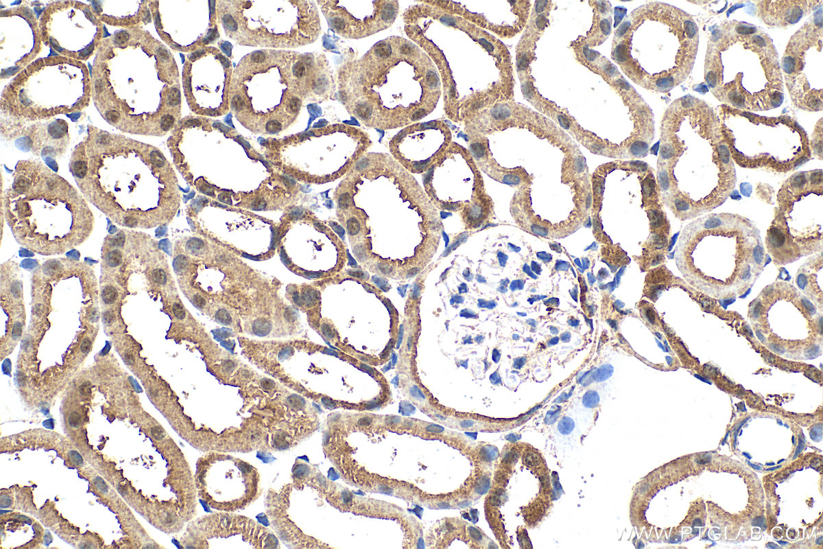 IHC staining of mouse kidney using 26478-1-AP
