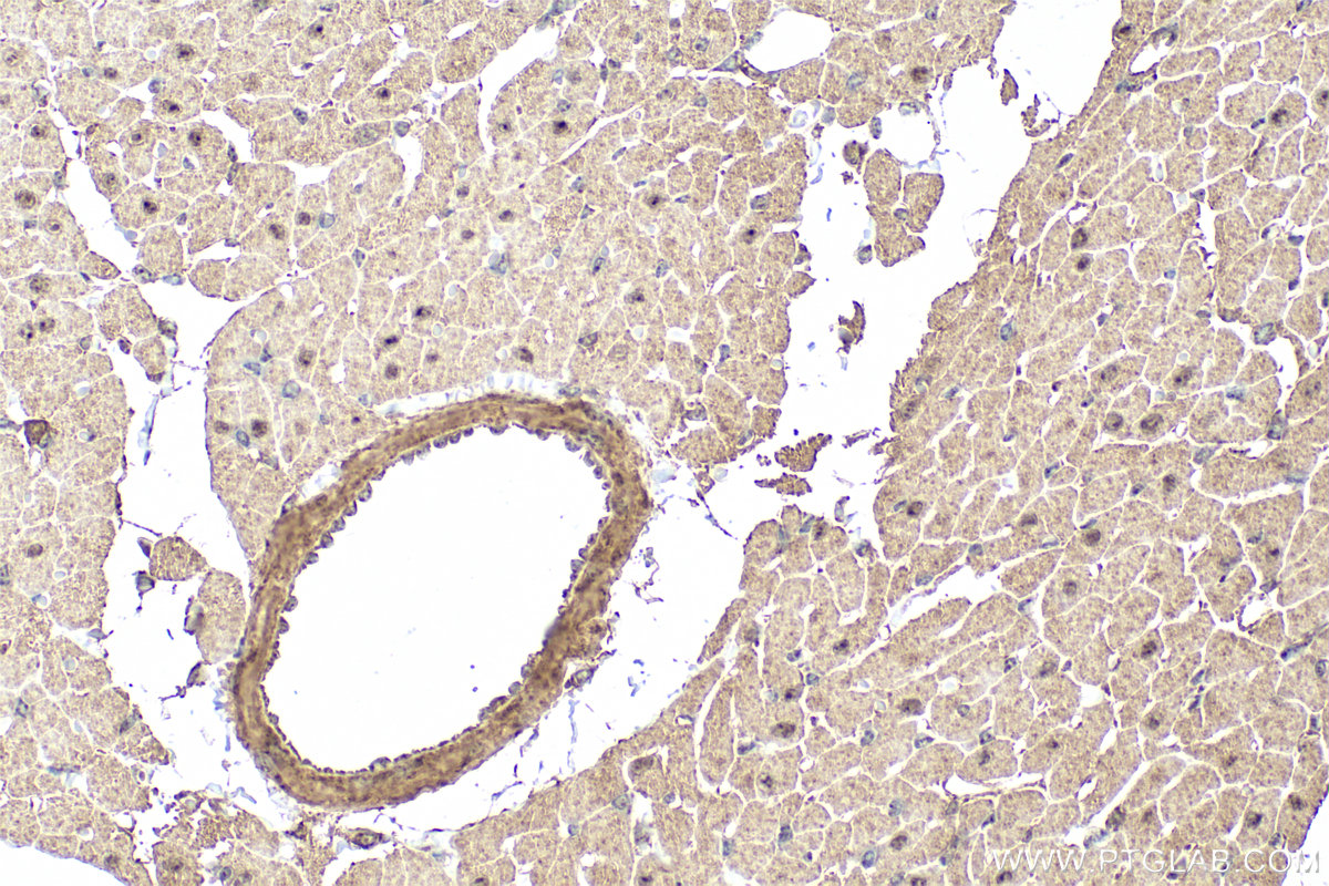 IHC staining of rat heart using 26478-1-AP