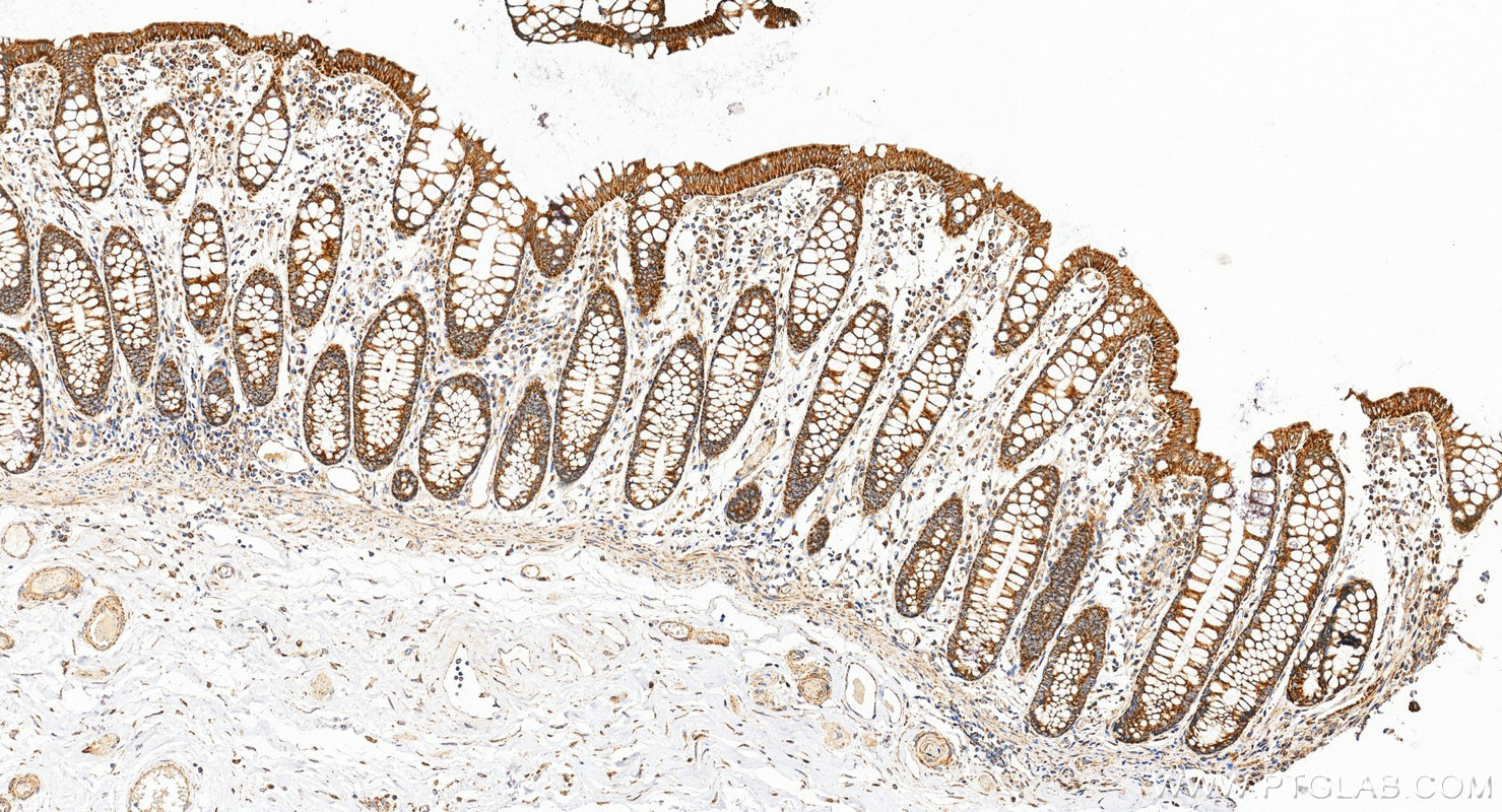 IHC staining of human colon using 88330-1-RR (same clone as 88330-1-PBS) IHC staining of human colon using 88330-1-RR (same clone as 88330-1-PBS)