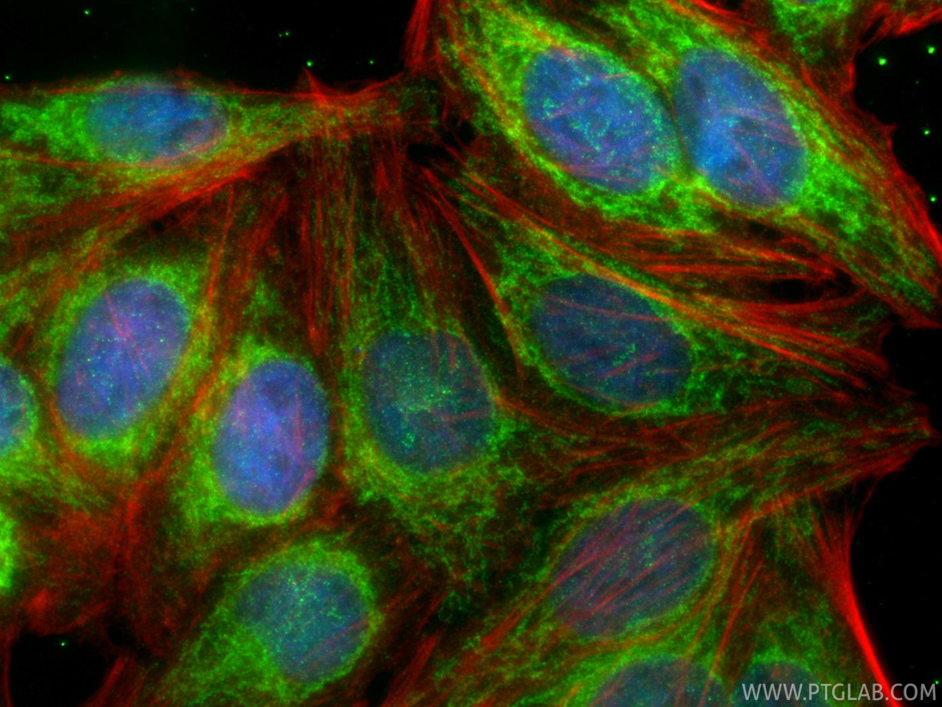 IF Staining of HepG2 using 88330-1-RR (same clone as 88330-1-PBS) IF Staining of HepG2 using 88330-1-RR (same clone as 88330-1-PBS)
