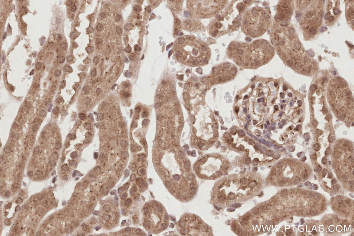 IHC staining of mouse kidney using 19820-1-AP IHC staining of mouse kidney using 19820-1-AP