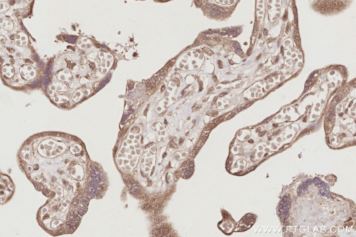 IHC staining of human placenta using 19820-1-AP IHC staining of human placenta using 19820-1-AP