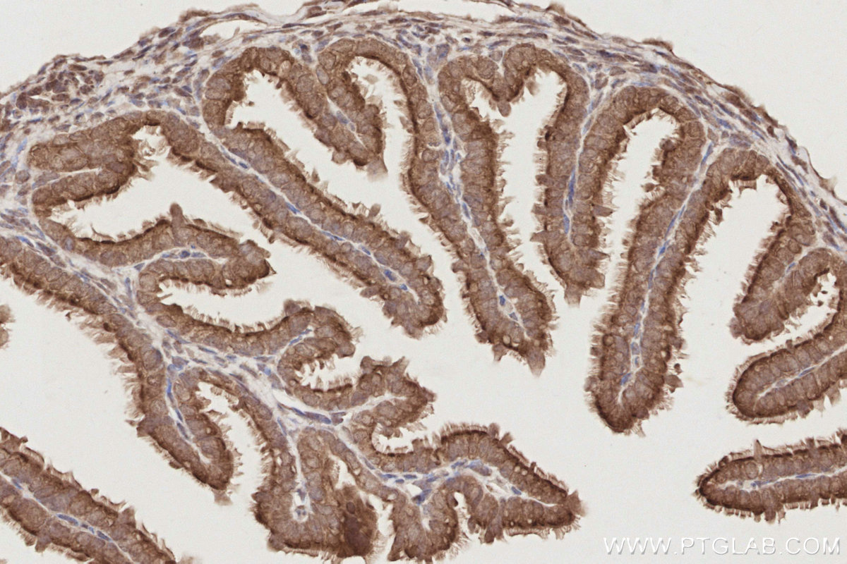 IHC staining of mouse ovary using 19820-1-AP IHC staining of mouse ovary using 19820-1-AP