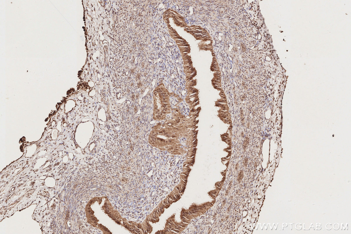 IHC staining of rat ovary using 19820-1-AP IHC staining of rat ovary using 19820-1-AP