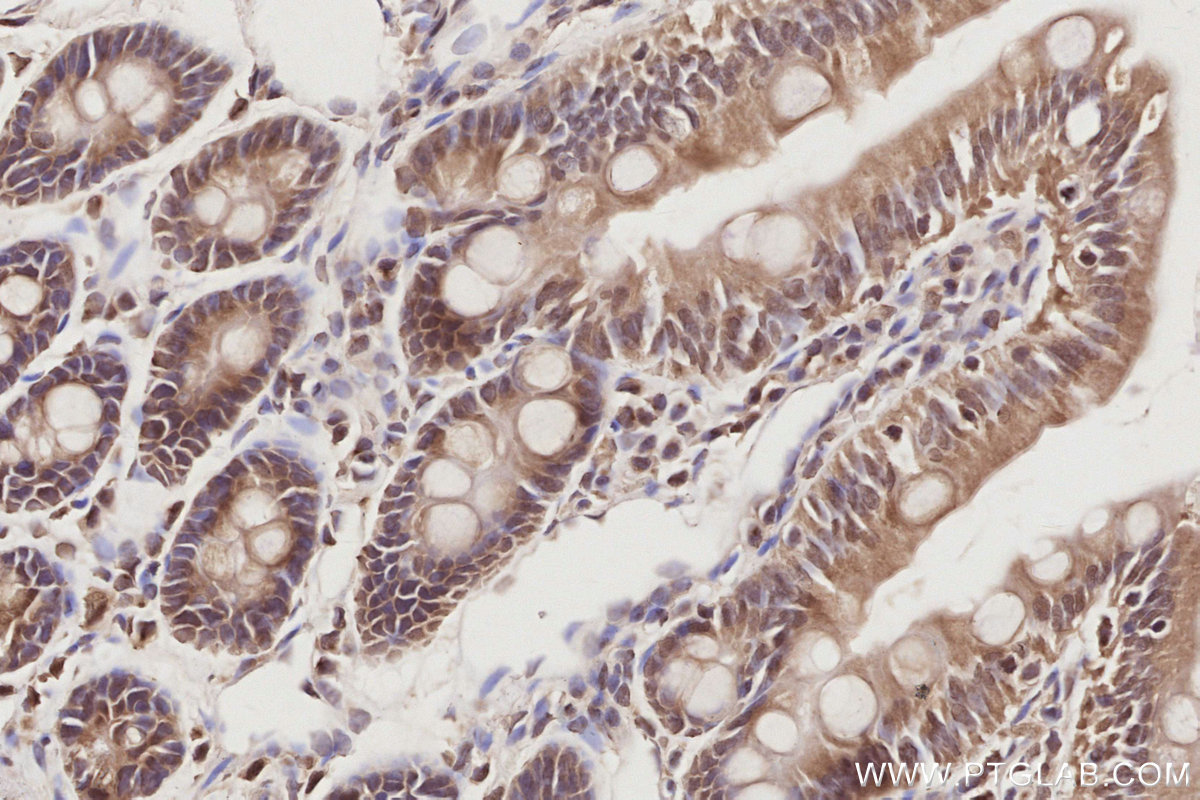 IHC staining of rat small intestine using 19820-1-AP IHC staining of rat small intestine using 19820-1-AP