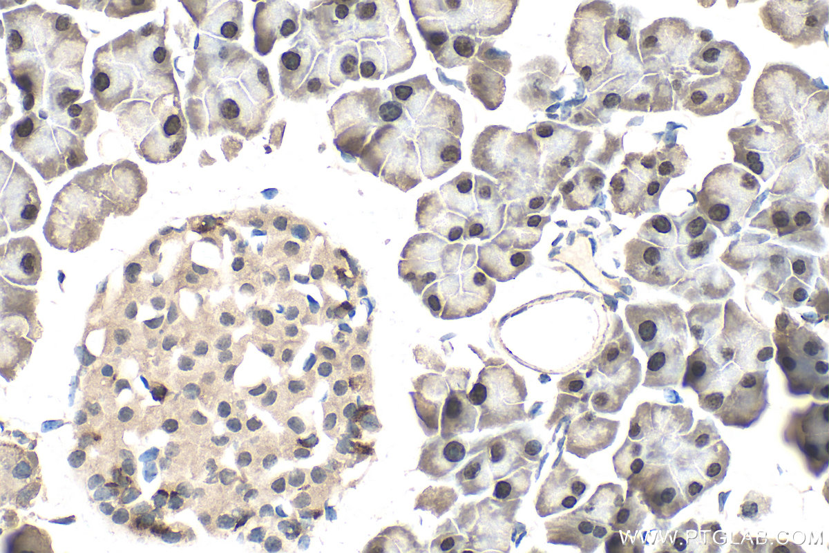 IHC staining of mouse pancreas using 29853-1-AP (same clone as 29853-1-PBS) IHC staining of mouse pancreas using 29853-1-AP (same clone as 29853-1-PBS)