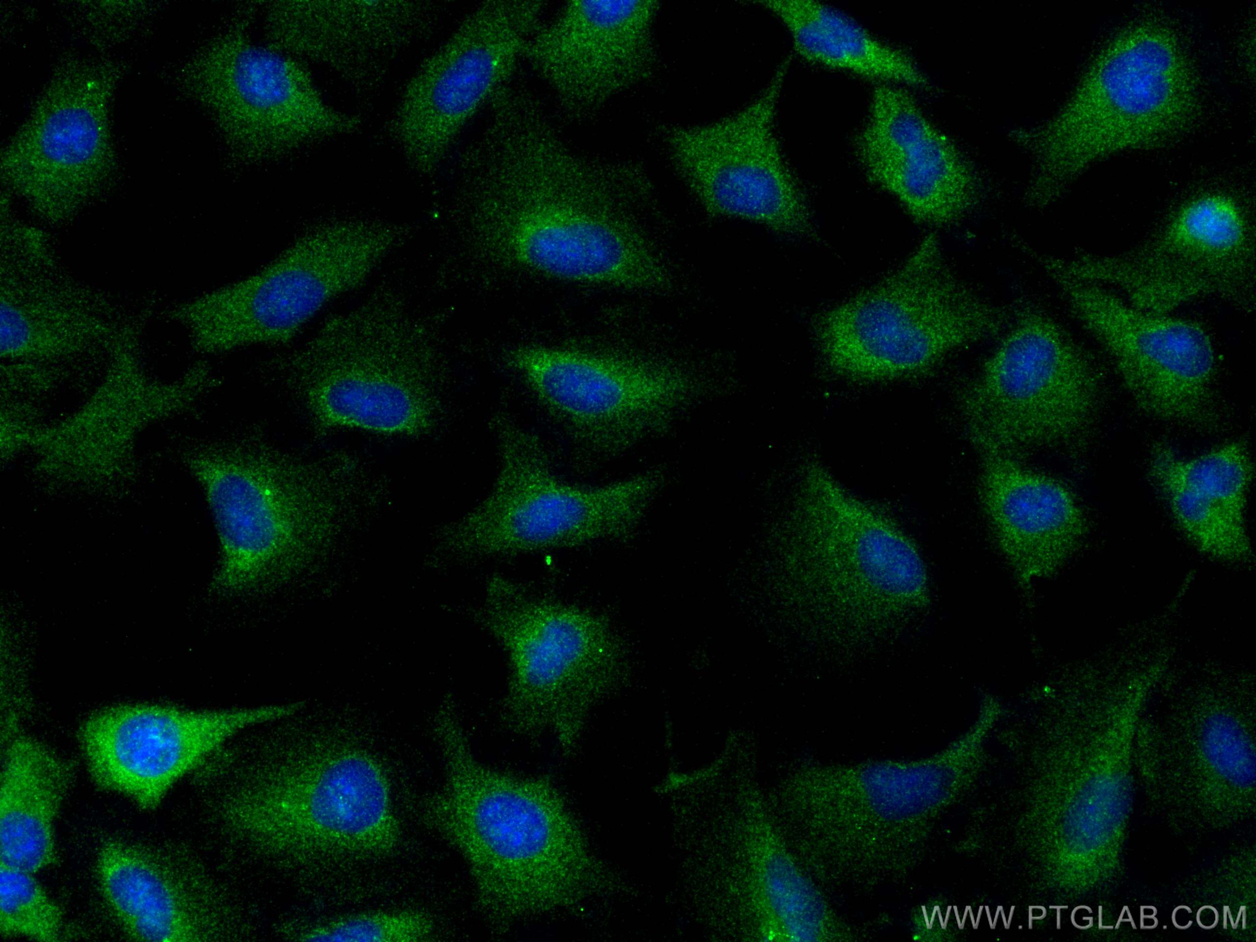 IF Staining of A549 using 17264-1-AP