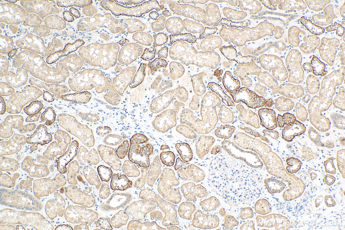 IHC staining of human kidney using 17264-1-AP