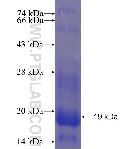 MITF fusion protein Ag10723 SDS-PAGE MITF fusion protein Ag10723 SDS-PAGE