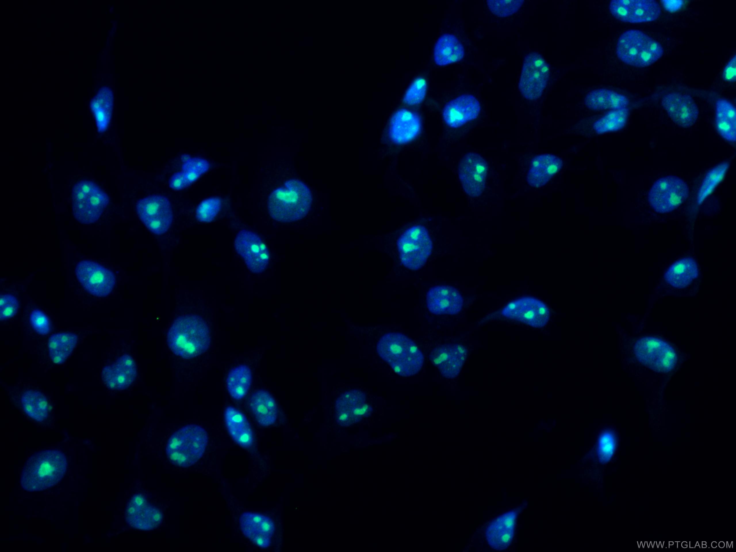 IF Staining of MCF-7 using 12615-1-AP