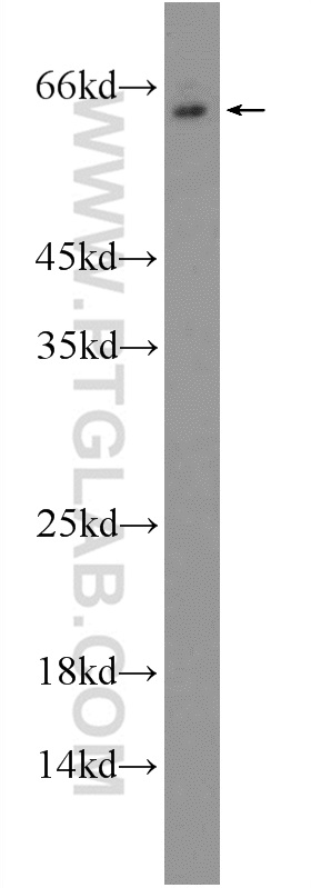 MKK7 Polyclonal antibody