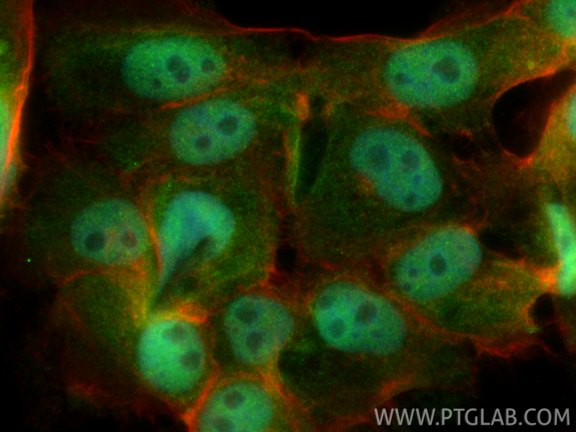 IF Staining of U-251 using 21166-1-AP IF Staining of U-251 using 21166-1-AP