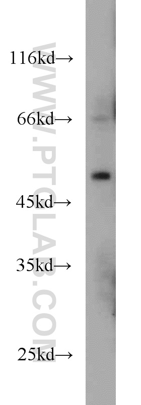 WB analysis of HeLa using 10136-1-AP