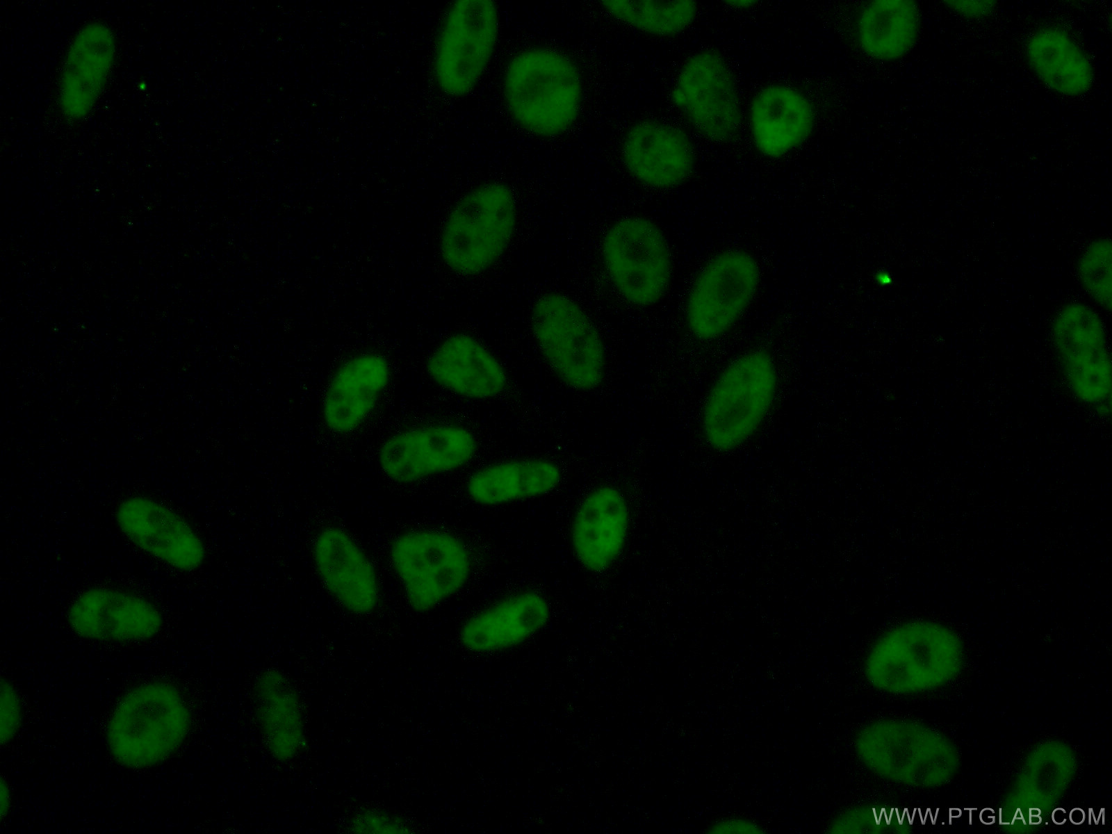 IF Staining of HepG2 using 66349-1-Ig