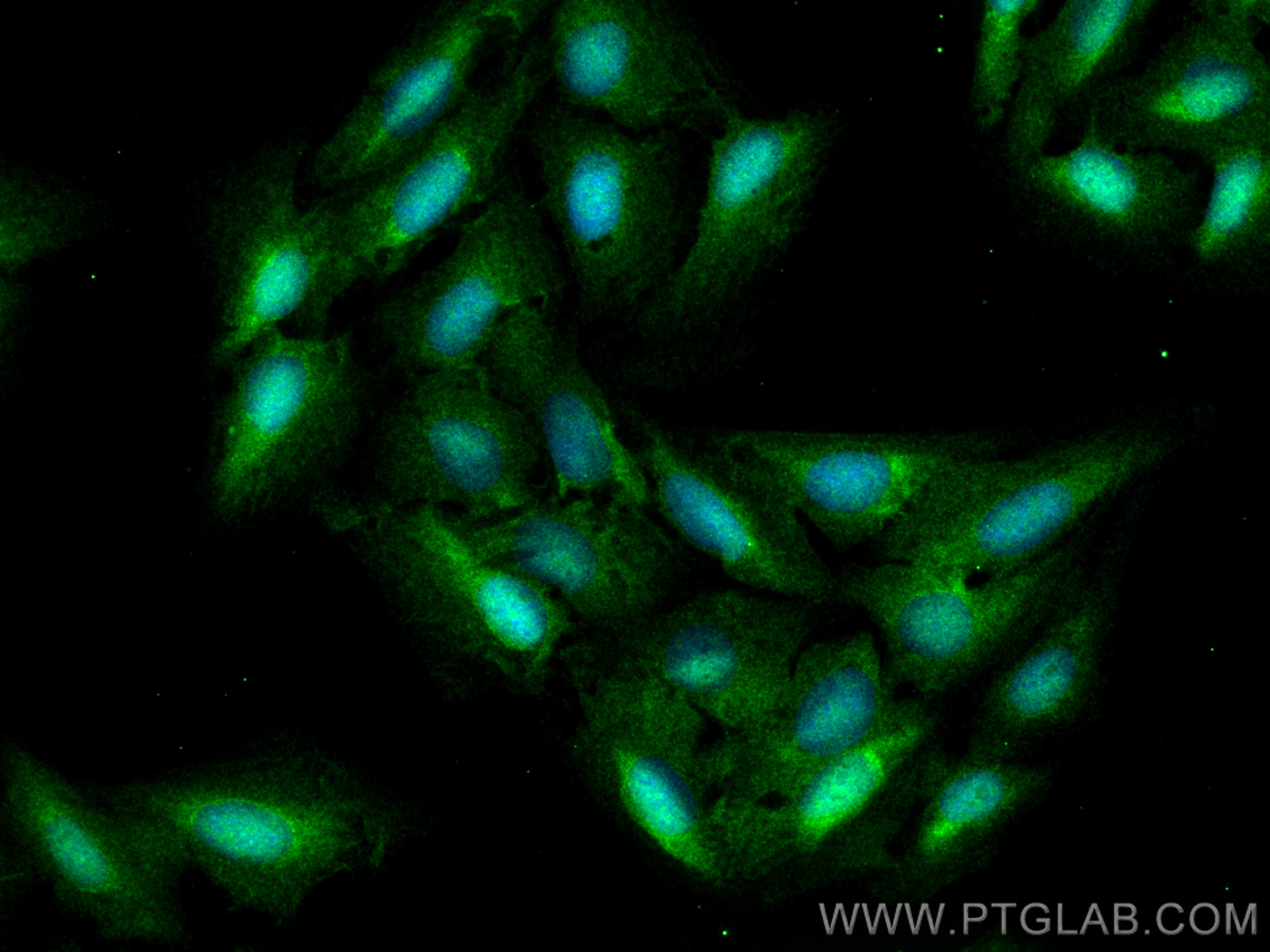 IF Staining of U2OS using 12238-1-AP