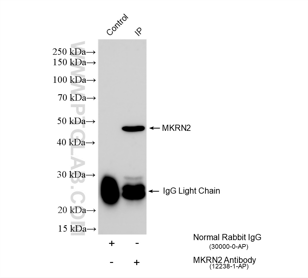 IP result of anti-MKRN2 (IP:12238-1-AP, 4ug; Detection:12238-1-AP 1:2000) with HeLa cells lysate 1400 ug. IP experiment of HeLa using 12238-1-AP