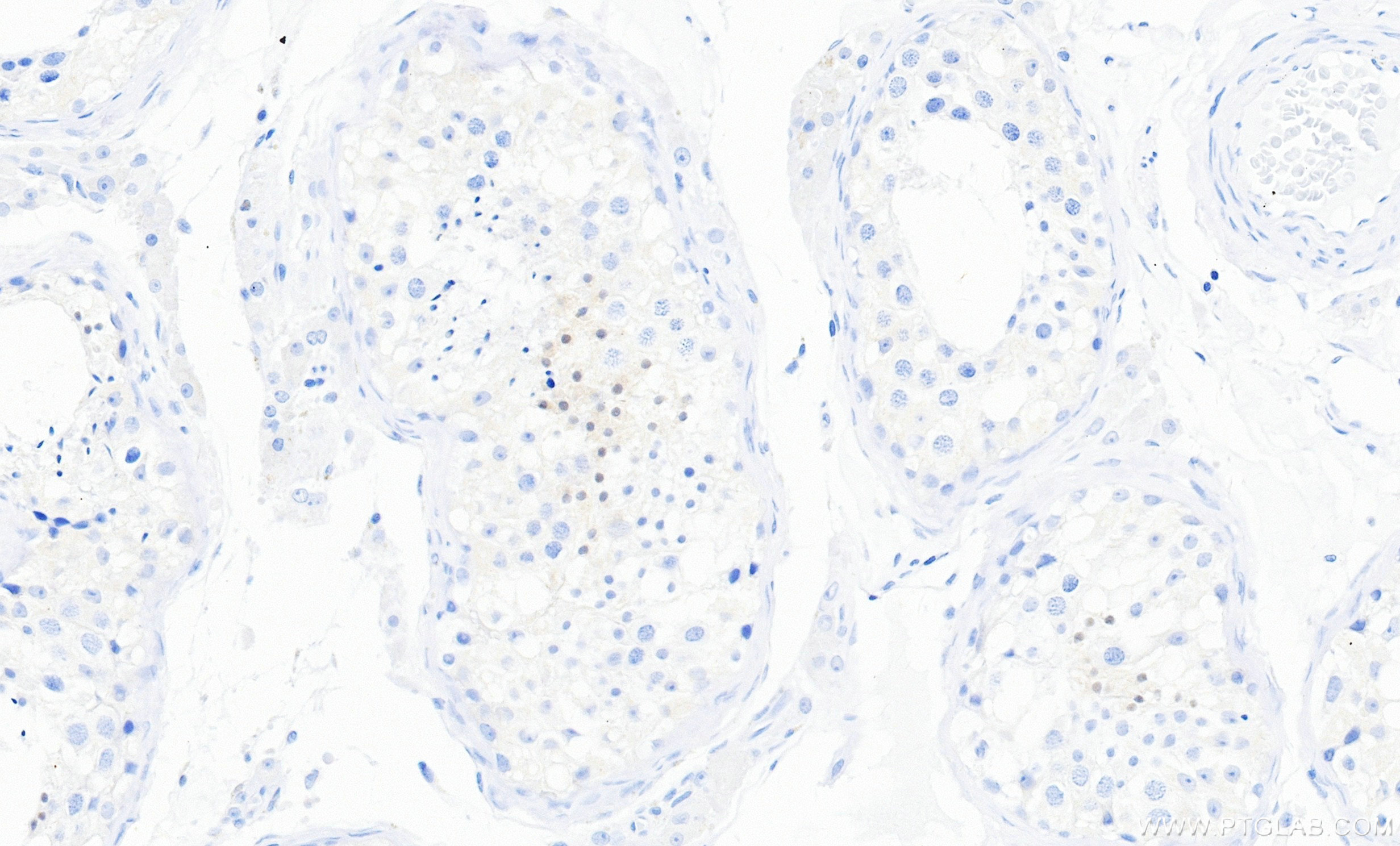 IHC staining of human testis using 87026-1-RR IHC staining of human testis using 87026-1-RR