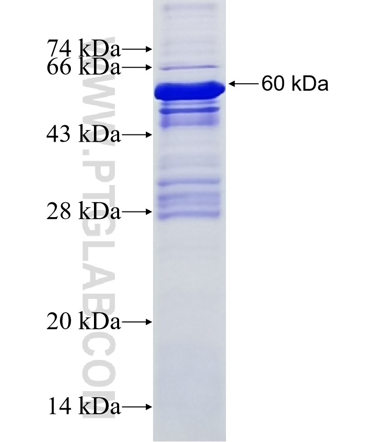 MKRN3 fusion protein Ag13270 SDS-PAGE MKRN3 fusion protein Ag13270 SDS-PAGE