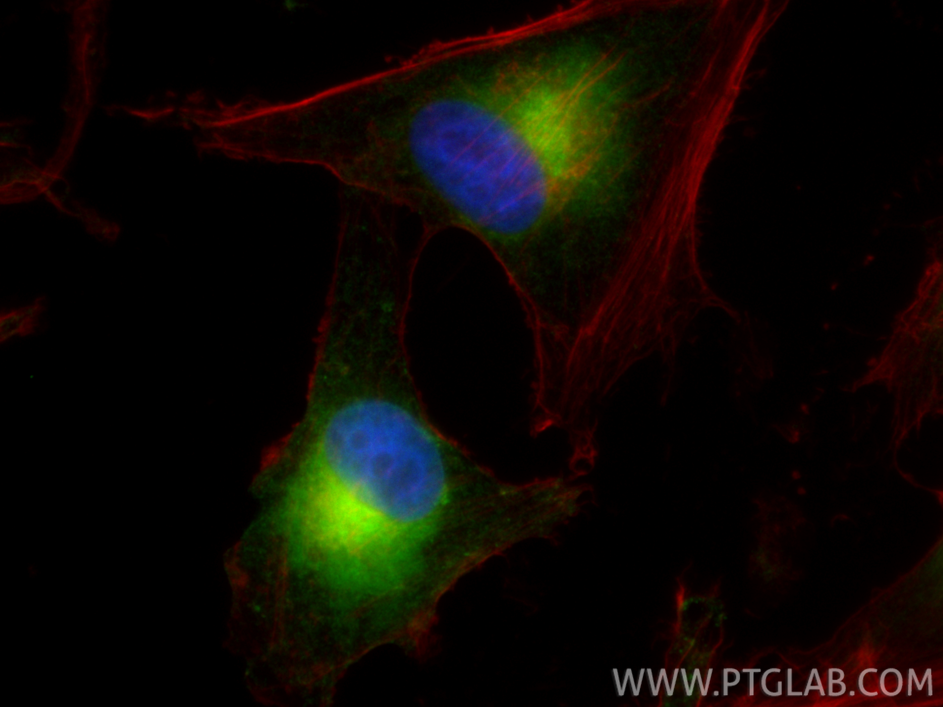 IF Staining of SK-MEL-28 using 18472-1-AP IF Staining of SK-MEL-28 using 18472-1-AP