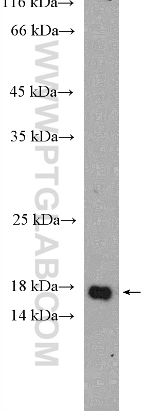 WB analysis of mouse eye using 18472-1-AP