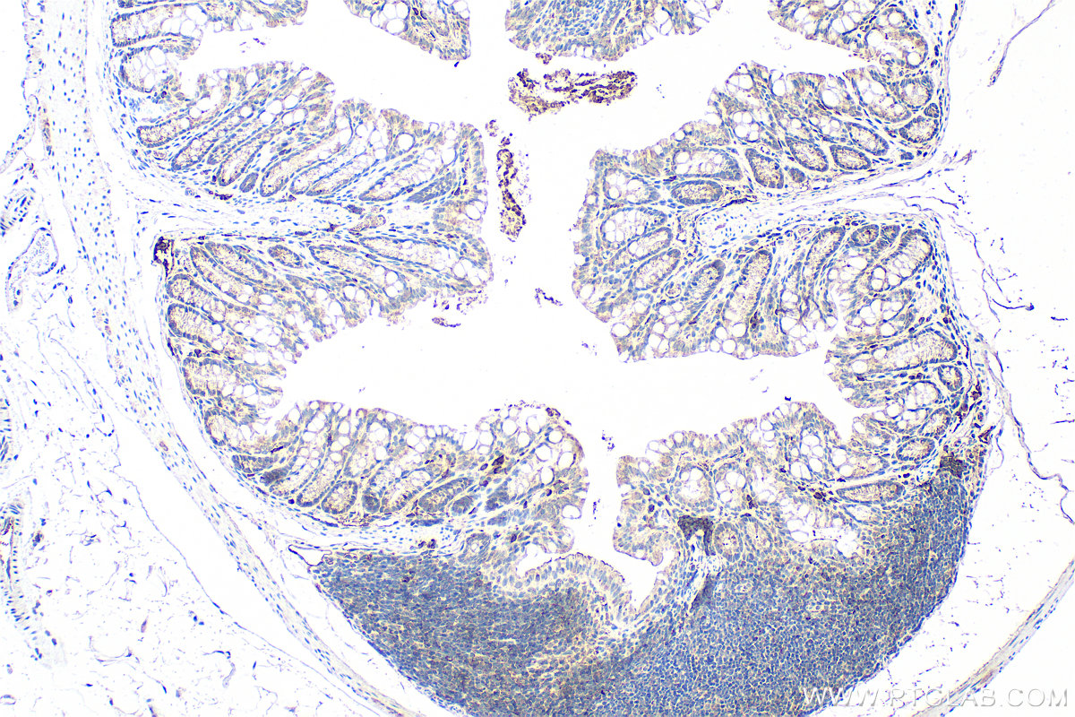 Immunohistochemical analysis of paraffin-embedded mouse colon tissue slide using 13186-1-AP (MLF1IP antibody) at dilution of 1:200 (under 10x lens). Heat mediated antigen retrieval with Tris-EDTA buffer (pH 9.0). IHC staining of mouse colon using 13186-1-AP
