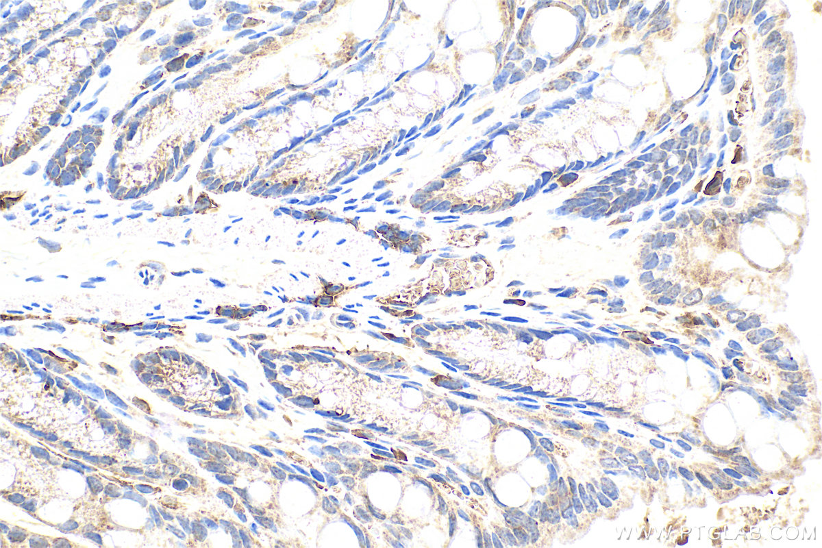 Immunohistochemical analysis of paraffin-embedded mouse colon tissue slide using 13186-1-AP (MLF1IP antibody) at dilution of 1:200 (under 40x lens). Heat mediated antigen retrieval with Tris-EDTA buffer (pH 9.0). IHC staining of mouse colon using 13186-1-AP