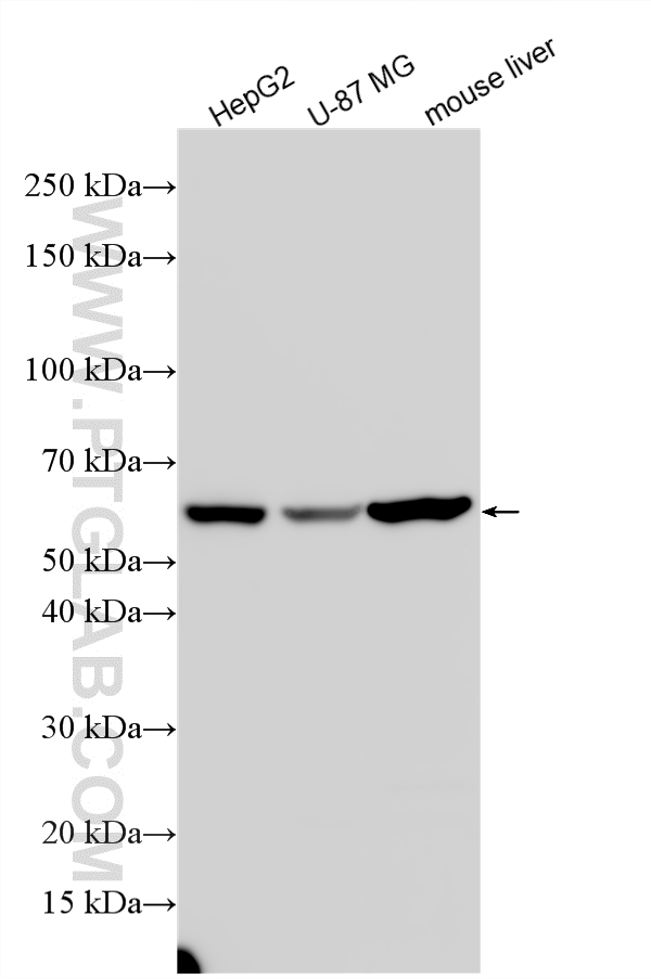 Various lysates were subjected to SDS PAGE followed by western blot with 13186-1-AP (MLF1IP antibody) at dilution of 1:3000 incubated at room temperature for 1.5 hours. WB analysis using 13186-1-AP
