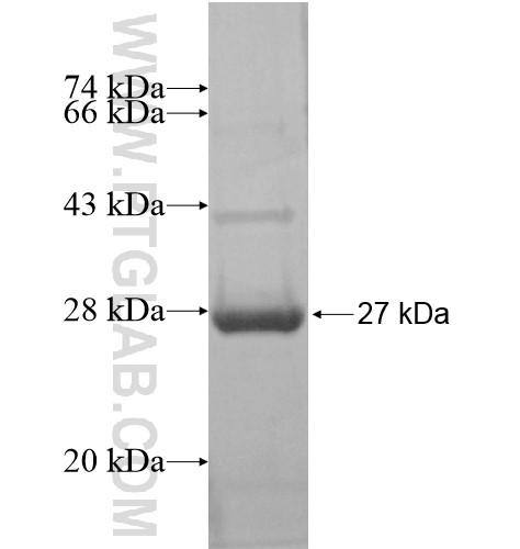 MLF1IP fusion protein Ag15271 SDS-PAGE MLF1IP fusion protein Ag15271 SDS-PAGE