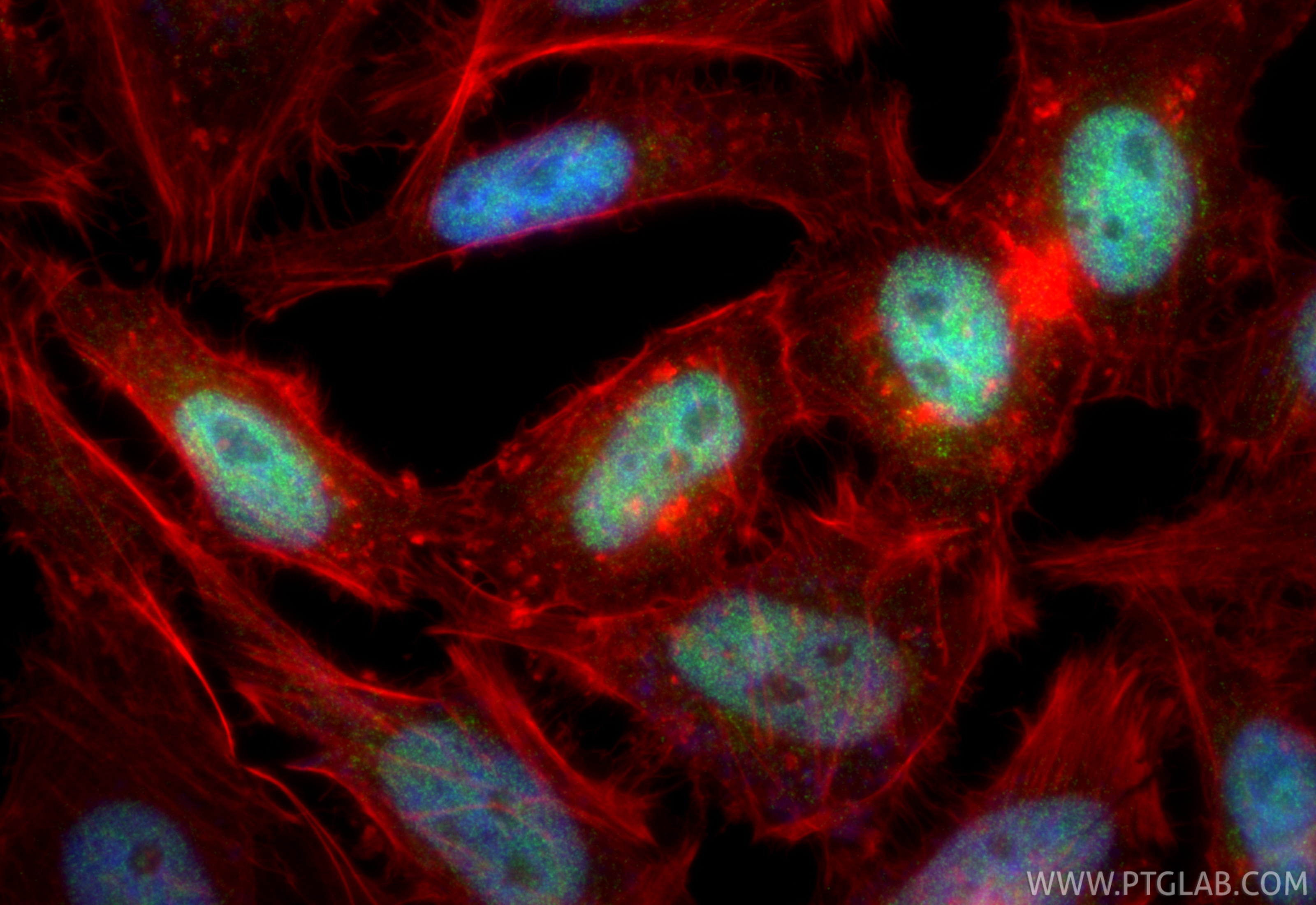 IF Staining of HeLa using 11697-1-AP
