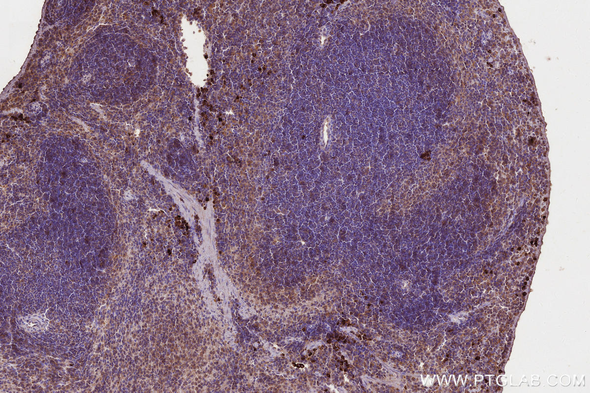 IHC staining of mouse spleen using 66675-1-Ig