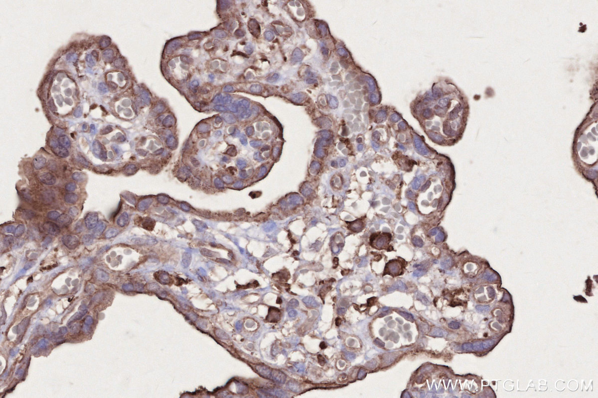 IHC staining of human placenta using 66675-1-Ig