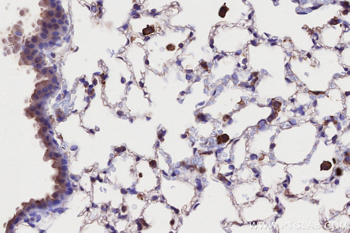 IHC staining of mouse lung using 66675-1-Ig