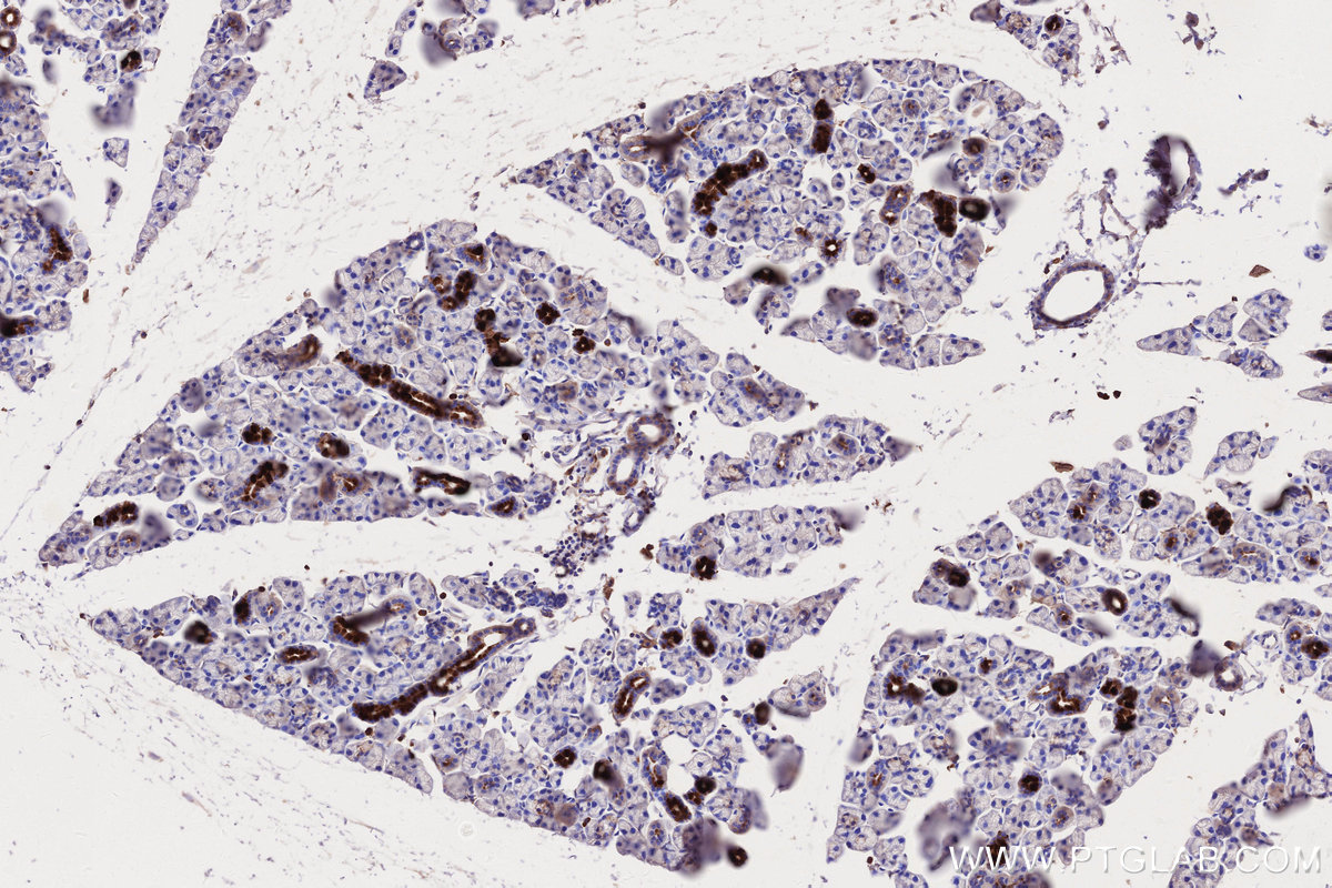 IHC staining of mouse salivary gland using 66675-1-Ig