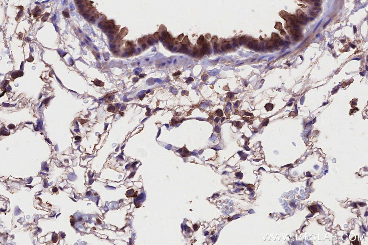 IHC staining of rat lung using 66675-1-Ig