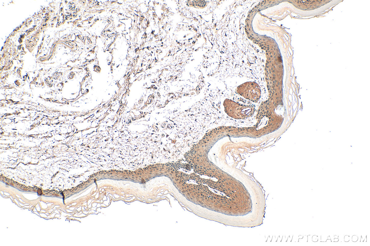 Immunohistochemical analysis of paraffin-embedded mouse skin tissue slide using 66675-1-Ig (MLKL antibody) at dilution of 1:1000 (under 10x lens). Heat mediated antigen retrieval with Tris-EDTA buffer (pH 9.0). IHC staining of mouse skin using 66675-1-Ig