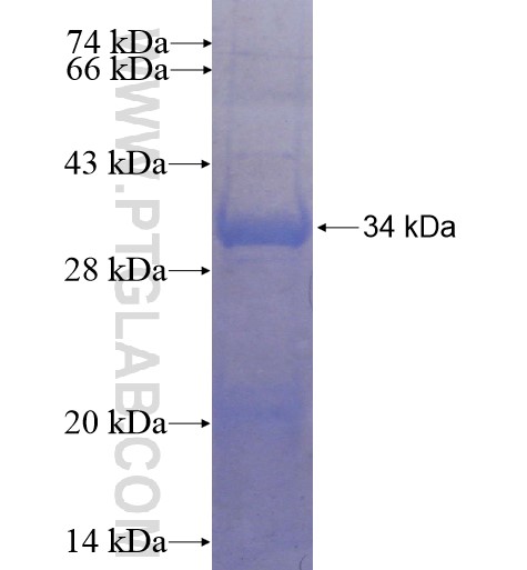 MLKL fusion protein Ag15626 SDS-PAGE MLKL fusion protein Ag15626 SDS-PAGE