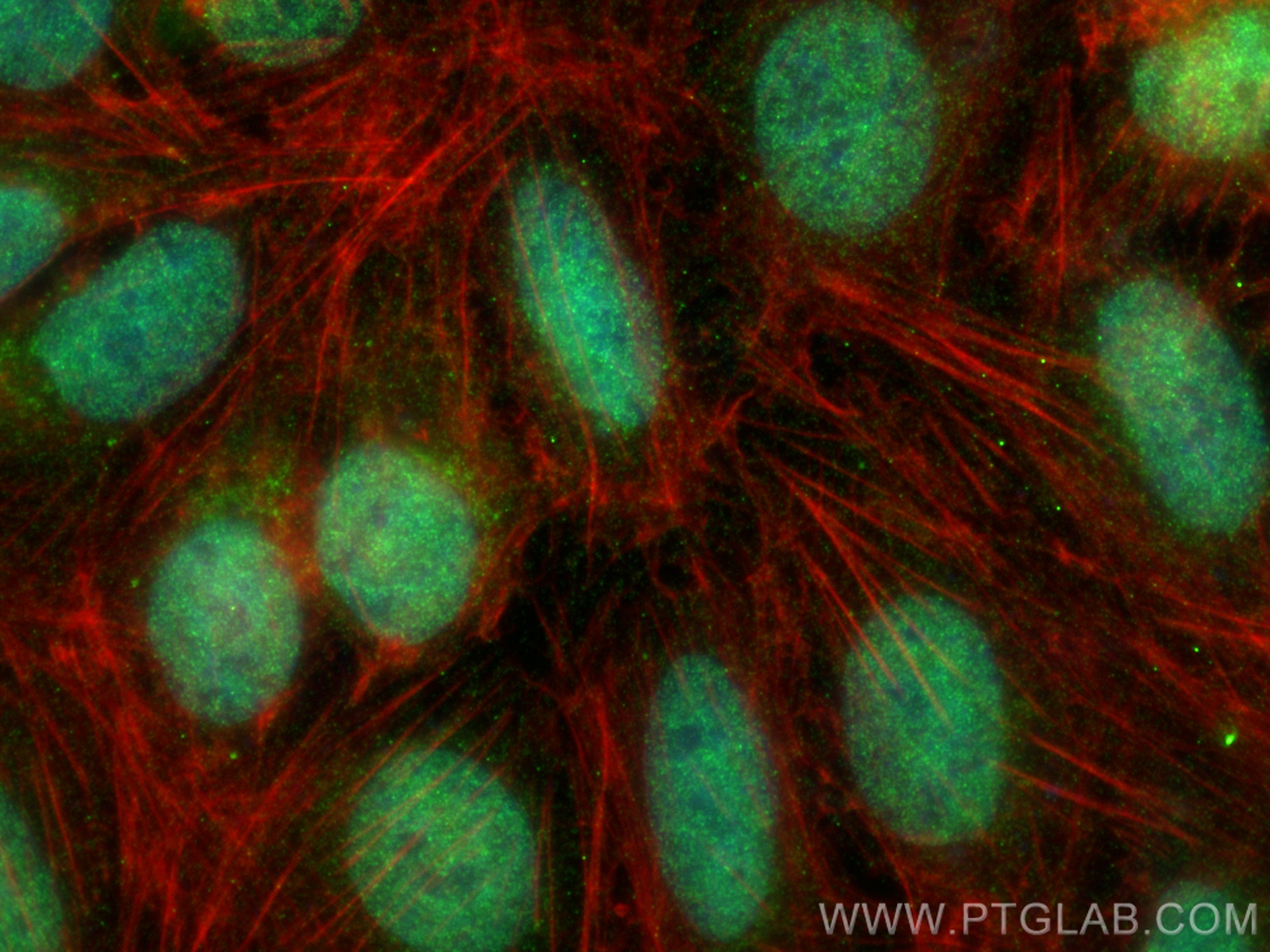 IF Staining of U2OS using 31396-1-AP