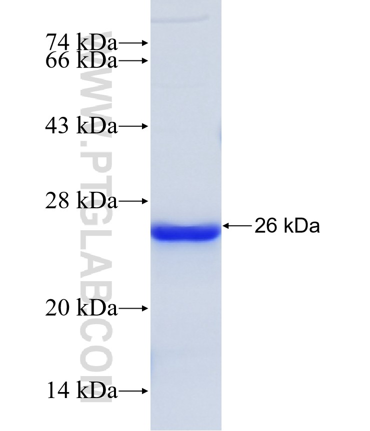 MLL4 fusion protein Ag35476 SDS-PAGE MLL4 fusion protein Ag35476 SDS-PAGE