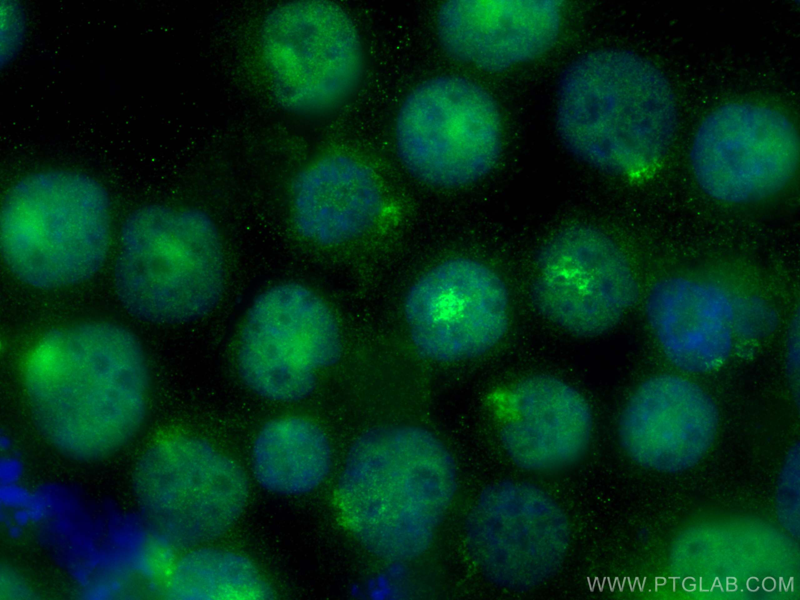 IF Staining of K-562 using 14540-1-AP