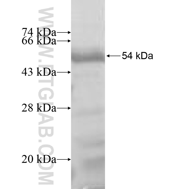 MLL5 fusion protein Ag6796 SDS-PAGE MLL5 fusion protein Ag6796 SDS-PAGE