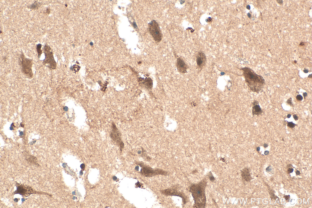 IHC staining of human brain using 31029-1-AP